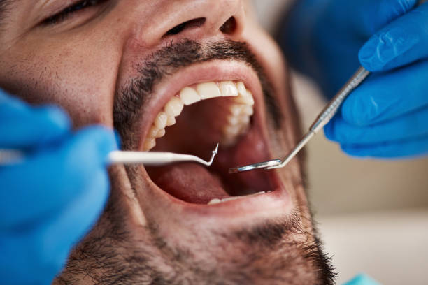 Best Cracked Tooth Emergency Dentist  in Pablo, MT